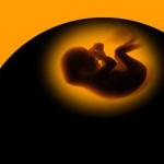aborto